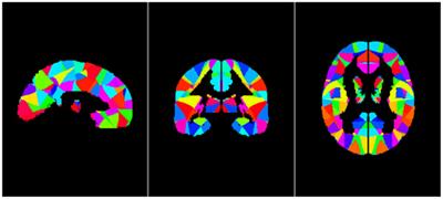 Changes in Brain Lateralization in Patients with Mild Cognitive Impairment and Alzheimer’s Disease: A Resting-State Functional Magnetic Resonance Study from Alzheimer’s Disease Neuroimaging Initiative